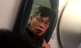 Bác sĩ David Dao bị thương sau khi bị lôi thô bạo khỏi máy bay của United Airlines hôm 9/4.