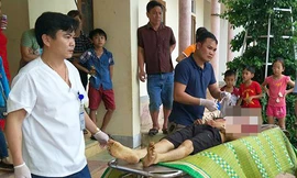 Nạn nhân được người nhà đưa tới Bệnh viện Đa khoa huyện Hương Khê cấp cứu. Ảnh: Đ.H 