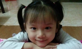 Bé Hải An hiến giác mạc trước khi qua đời. Ảnh: T.D