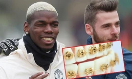 Ngôi sao M.U khoe niềng răng bằng vàng