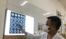 37 công nhân bị nhiễm độc methanol, một trường hợp tử vong