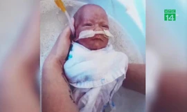 Chào đời chỉ nặng bằng lon nước ngọt, bé trai sống sót kỳ diệu