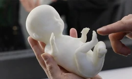 Công nghệ in 3D đem tới mô hình vô cùng chân thực của thai nhi