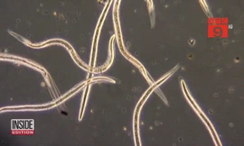 Nghịch cát khi đi tắm biển, hãi hùng bị giun móc xâm nhập khắp cơ thể