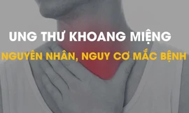 Ung thư khoang miệng: Nguyên nhân, nguy cơ mắc bệnh, cách nhận biết