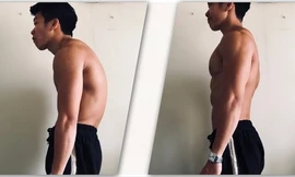 Thói quen đơn giản tránh gù lưng, mỏi cổ