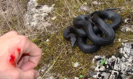 Khi bị rắn độc cắn cần phải làm gì?