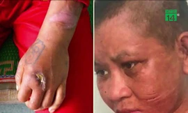 Người làm thuê tố bị chủ bẻ răng, cắt tai như thời trung cổ