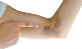 Nếu cơ thể bạn gặp những triệu chứng này, hãy đi bác sỹ ngay