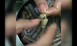 Kinh hoàng giòi nằm trong ruột ốc móng tay