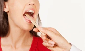 Tại sao không nên cắt amidan nếu chưa cần thiết?