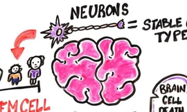 Mất ngủ, hút thuốc, uống rượu... phá hủy não bộ thế nào?