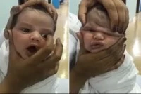 Y tá bị sa thải vì vò mặt bé sơ sinh