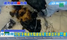 Mải chơi điện thoại đang sạc, bé trai bị giật cháy xém ngực