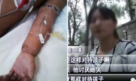 Bé 2 tuổi hôn mê vì bị người tình của mẹ đánh đập tàn bạo