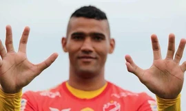 Thủ môn Brazil sở hữu bàn tay lạ kỳ có... 6 ngón