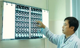 Bác sĩ xem kết quả chẩn đoán hình ảnh. Ảnh: Bệnh viện cung cấp