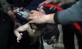 Hình ảnh do tổ chức Mũ Trắng cung cấp, cho thấy hình ảnh một em nhỏ được sơ cứu sau khi nghi phơi nhiễm chất độc hoá học. Ảnh: Reuters