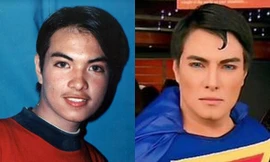 Chàng trai trẻ 'hóa' siêu nhân sau 23 lần phẫu thuật