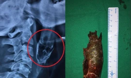 Phần đầu con cá dài hơn 11cm chui xuống họng Dash. Ảnh: Mirror