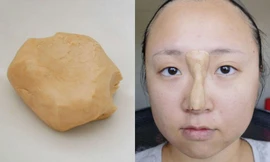 Sốc với mẹo nâng mũi bằng… bột mỳ
