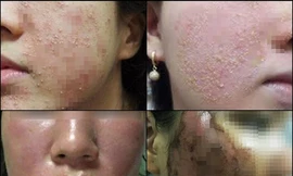 Ảnh minh họa: Internet