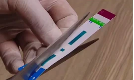 Hàng nghìn que thử HIV, viêm gan B bị cắt đôi trước khi tiến hành xét nghiệm tại Bệnh viện đa khoa Xanh Pôn nhằm bớt xén vật tư y tế