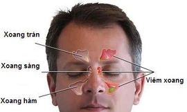 Ảnh minh hoạ: Internet