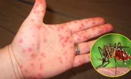 Ảnh minh hoạ: Internet