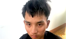 Bắt nam thanh niên đâm chủ tiệm tạp hoá để cướp 2 triệu đồng
