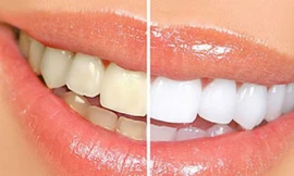 Ảnh minh họa: Internet