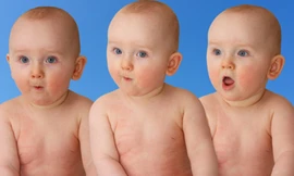 Sinh 3 đồng trứng là chuyện cực hiếm - Ảnh minh họa: Shutterstock