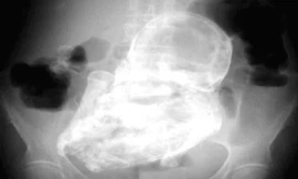 Ảnh minh họa: Internet