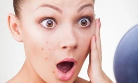 Ảnh minh họa: Internet