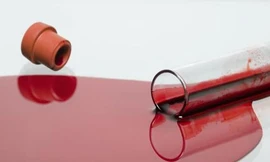 Ảnh minh hoạ: Internet