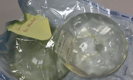 Ảnh minh họa: Internet