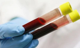 Ảnh minh họa: Internet