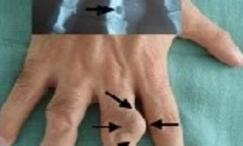 Ảnh minh họa: Internet