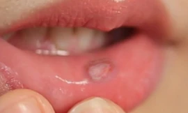 Ảnh minh họa: Internet