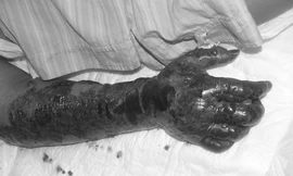 Ảnh minh họa: Internet