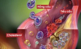 Ảnh minh họa: Internet