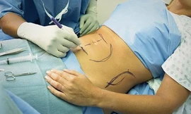 Ảnh minh họa: Internet