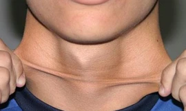 Ảnh minh họa: Internet