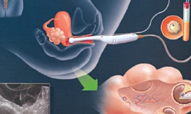 Ảnh minh họa: Internet