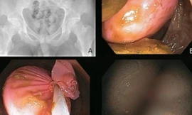 Ảnh minh họa: Internet