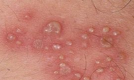 Ảnh minh hoạ: Internet