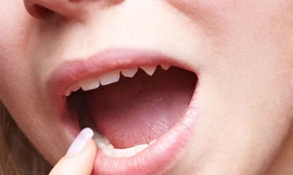 Ảnh minh hoạ: Internet