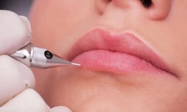 Ảnh minh hoạ: Internet