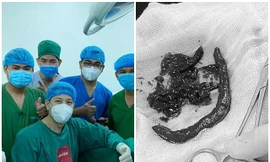 Phát hiện đỉa trong dương vật một người đàn ông, bác sĩ phẫu thuật “chết sững“