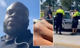 Đụng nhầm xe của cao thủ UFC, tên trộm bị đánh 'sấp mặt'